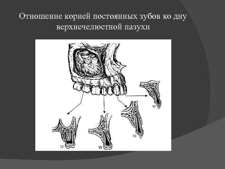 Отношение корней постоянных зубов ко дну верхнечелюстной пазухи 