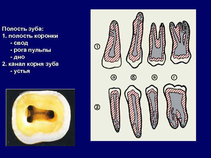 Полость зуба: 1. полость коронки - свод - рога пульпы - дно 2. канал