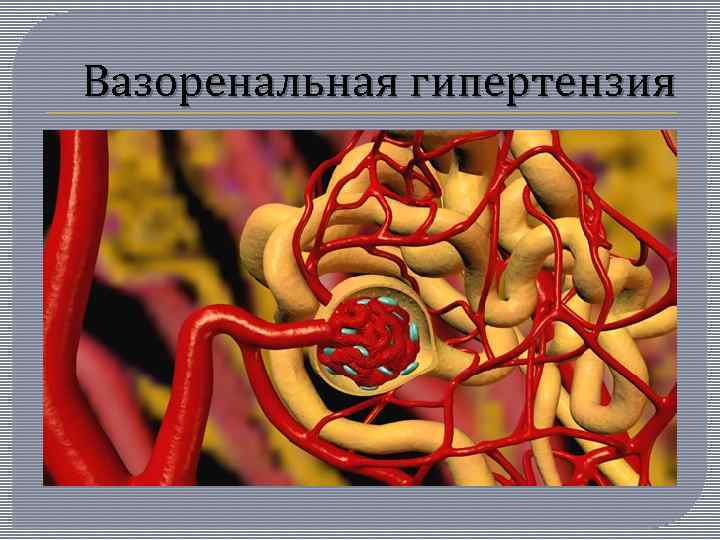 Вазоренальная гипертензия 