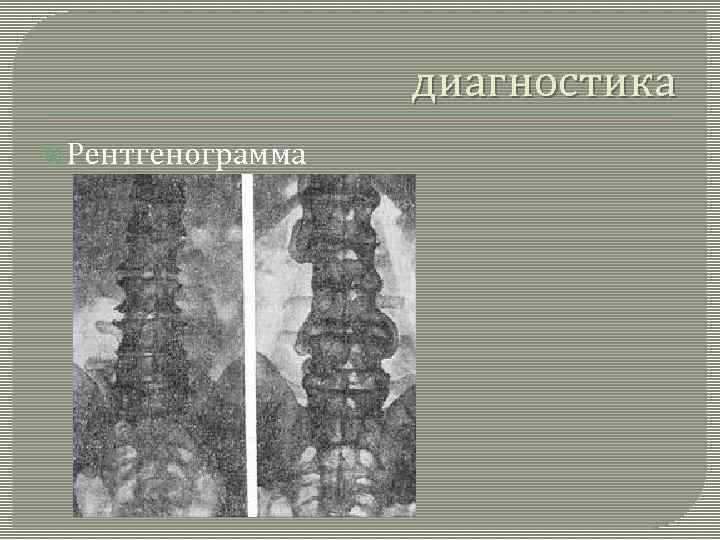 диагностика Рентгенограмма 