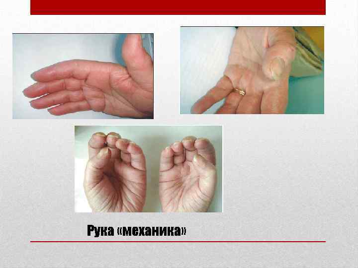 Рука «механика» 