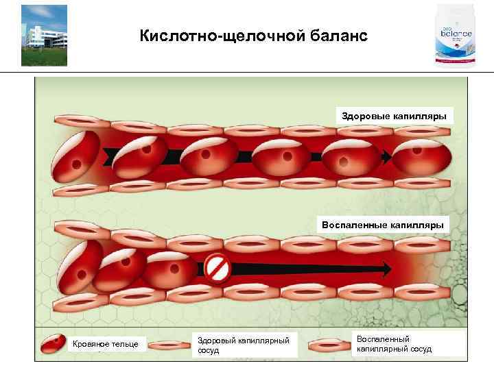 Кислотно-щелочной баланс _________________________________________ Здоровые капилляры Воспаленные капилляры Кровяное тельце Здоровый капиллярный сосуд Воспаленный капиллярный