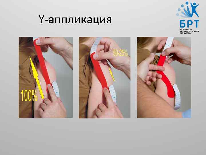 Y-аппликация 