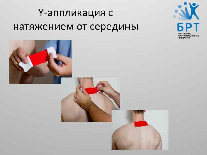 Y-аппликация с натяжением от середины 