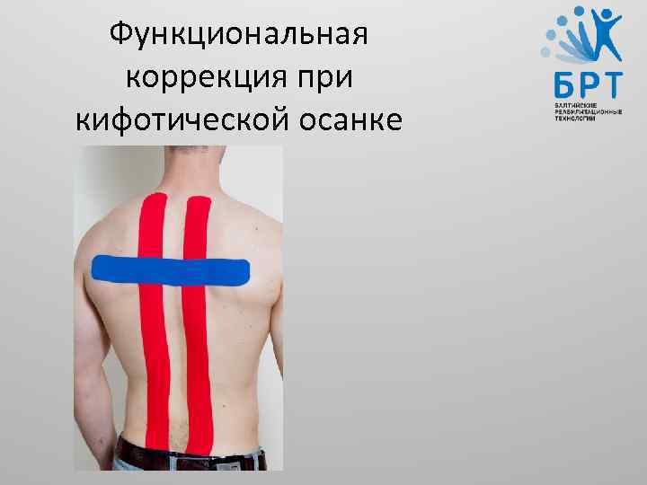 Функциональная коррекция при кифотической осанке 