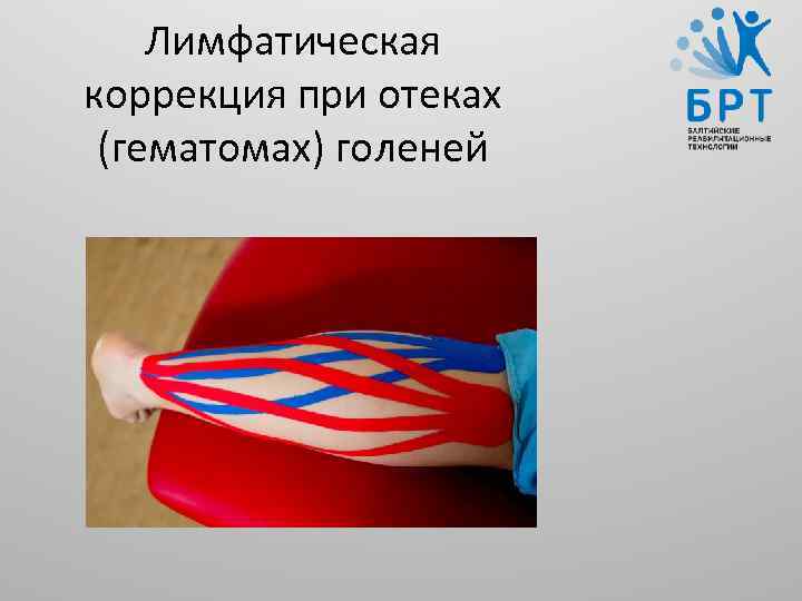 Лимфатическая коррекция при отеках (гематомах) голеней 