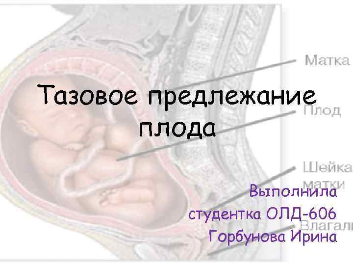 Тазовое предлежание плода Выполнила студентка ОЛД-606 Горбунова Ирина 