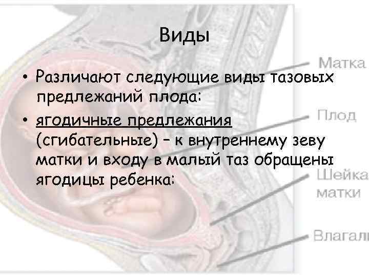 Виды • Различают следующие виды тазовых предлежаний плода: • ягодичные предлежания (сгибательные) – к