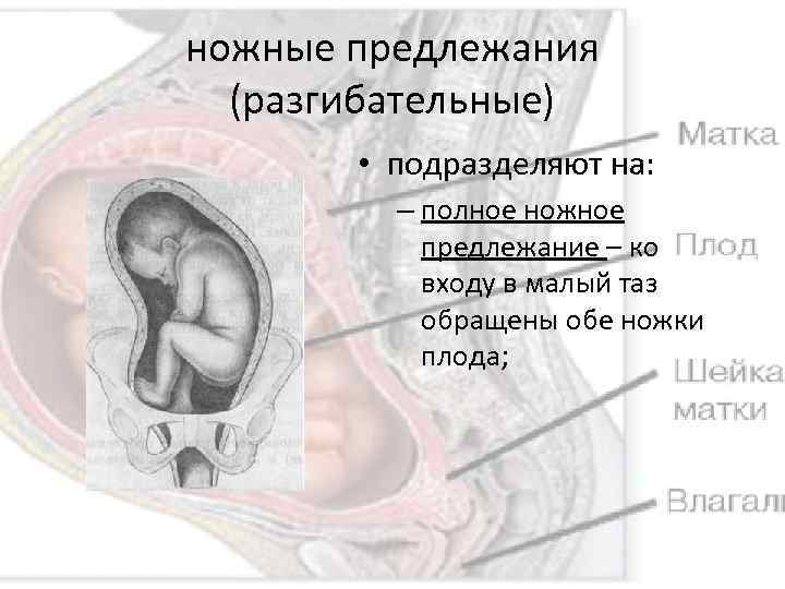 ножные предлежания (разгибательные) • подразделяют на: – полное ножное предлежание – ко входу в