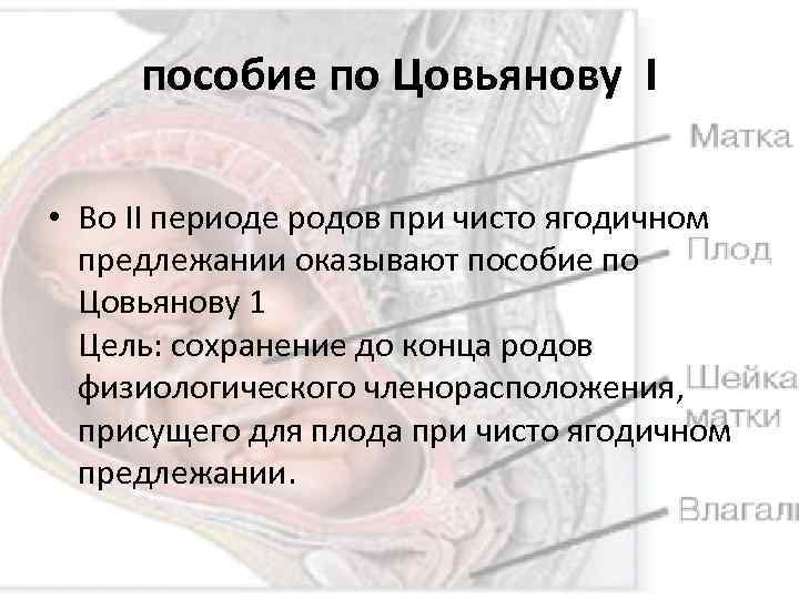 пособие по Цовьянову I • Во II периоде родов при чисто ягодичном предлежании оказывают