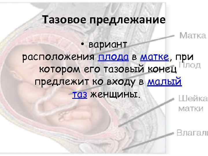 Предлежание в малом тазу. Варианты тазового предлежания плода. Предлежащая часть плода тазовая. Предлежит тазовый конец плода. Классификация тазовых предлежаний.