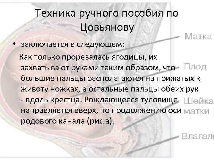 Техника ручного пособия по Цовьянову • заключается в следующем: Как только прорезалась ягодицы, их