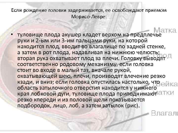 Если рождение головки задерживается, ее освобождают приемом Морисо-Левре: • туловище плода акушер кладет верхом