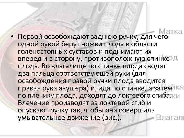  • Первой освобождают заднюю ручку, для чего одной рукой берут ножки плода в