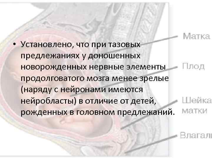 Пособия при ягодичном предлежании. Упражнения для переворота ребенка при тазовом предлежании в головное. Роды при тазовом предлежании видео.