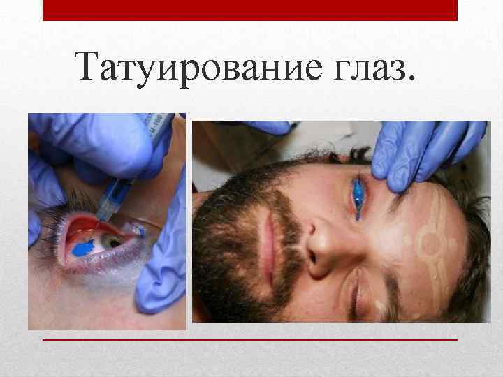 Татуирование глаз. 