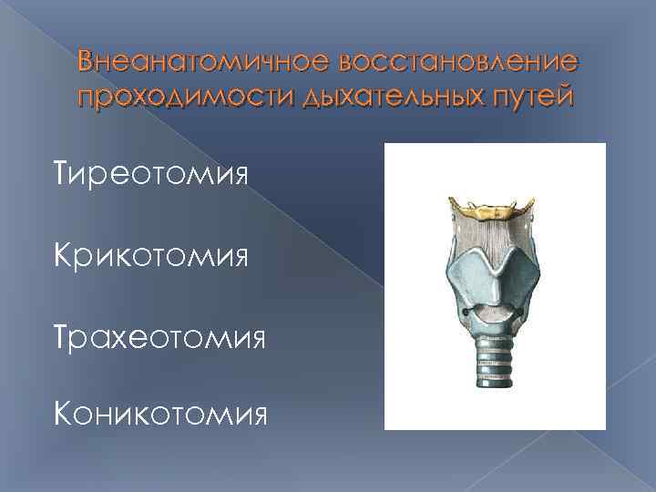 Внеанатомичное восстановление проходимости дыхательных путей Тиреотомия Крикотомия Трахеотомия Коникотомия 