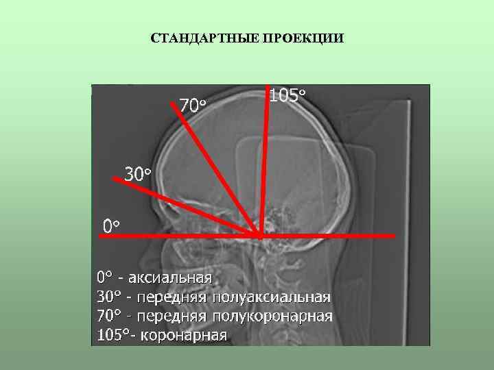 СТАНДАРТНЫЕ ПРОЕКЦИИ 