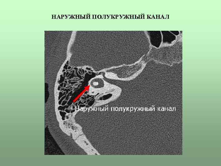 Цервикальный канал картинка