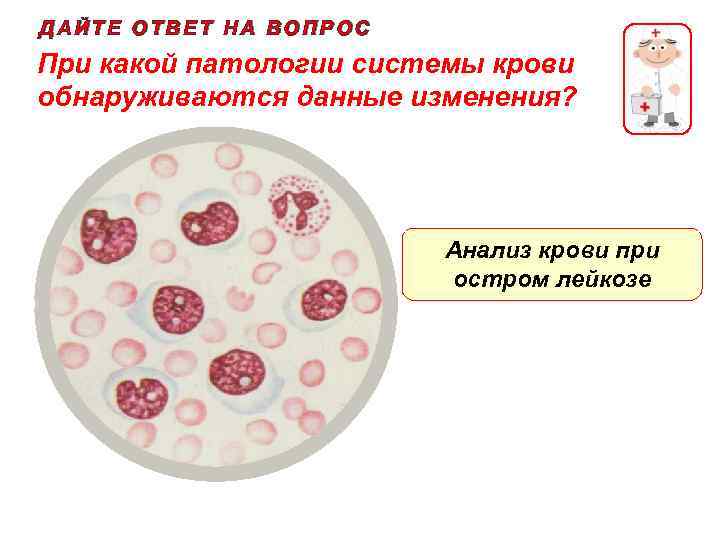 ДАЙТЕ ОТВЕТ НА ВОПРОС При какой патологии системы крови обнаруживаются данные изменения? Анализ крови