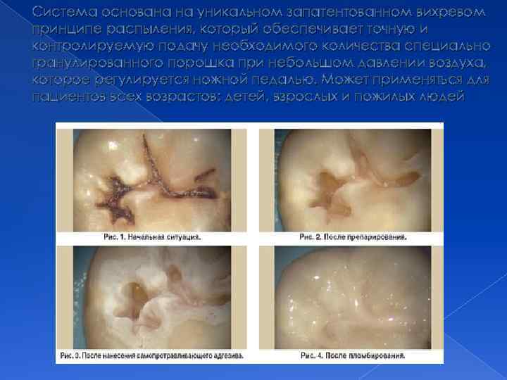 Система основана на уникальном запатентованном вихревом принципе распыления, который обеспечивает точную и контролируемую подачу