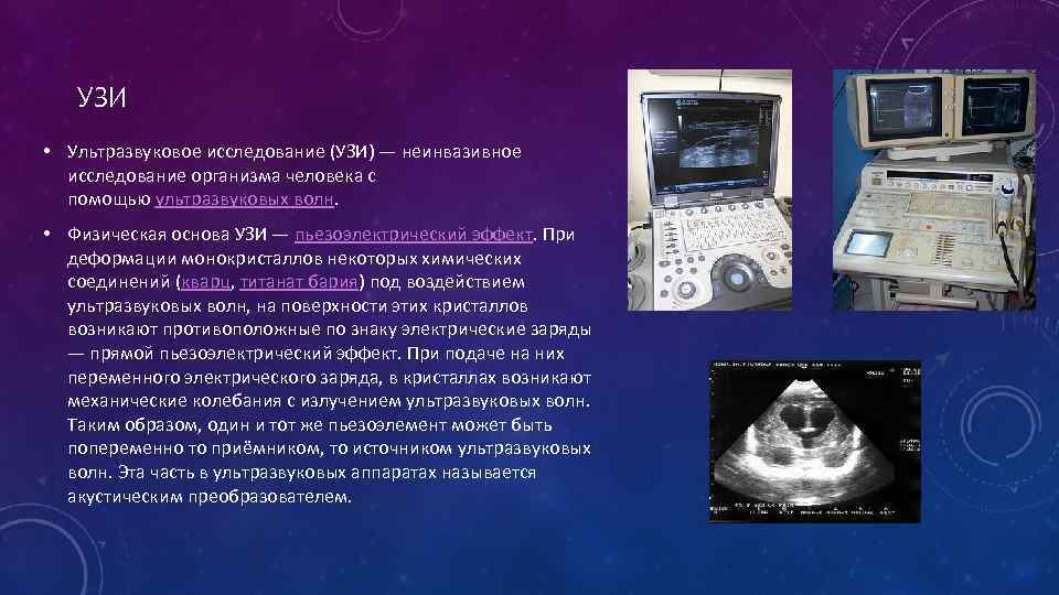 Ультразвуковые методы исследования