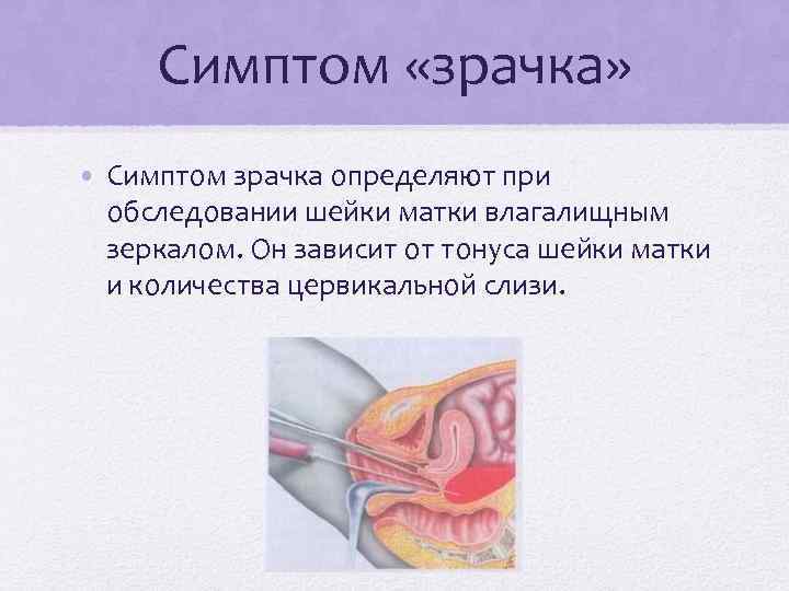 Эрозия шейки матки презентация