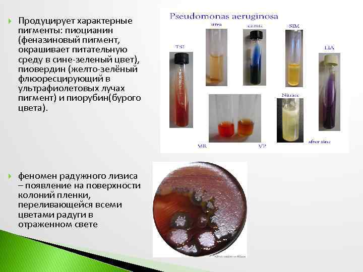  Продуцирует характерные пигменты: пиоцианин (феназиновый пигмент, окрашивает питательную среду в сине-зеленый цвет), пиовердин