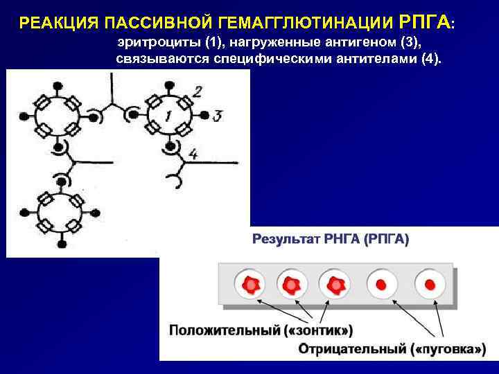 РЕАКЦИЯ ПАССИВНОЙ ГЕМАГГЛЮТИНАЦИИ РПГА: эритроциты (1), нагруженные антигеном (3), связываются специфическими антителами (4). 