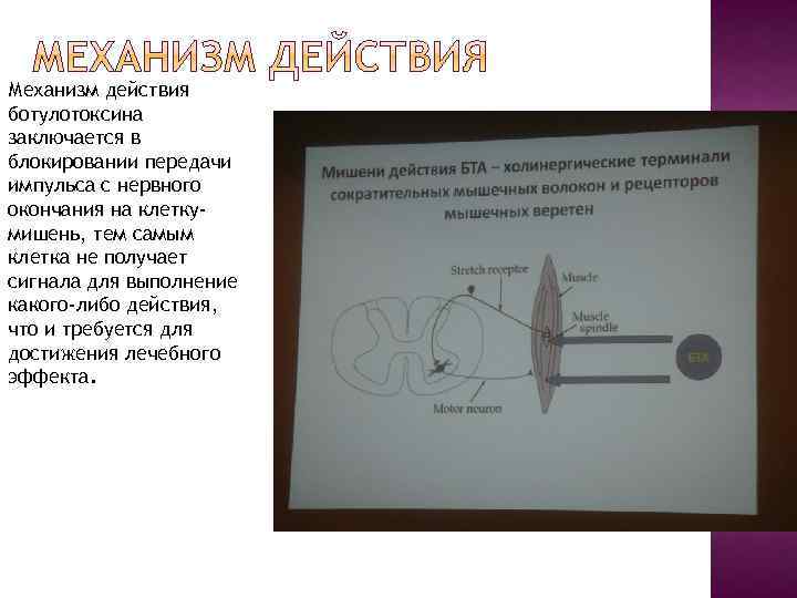 Механизм действия ботулотоксина заключается в блокировании передачи импульса с нервного окончания на клеткумишень, тем