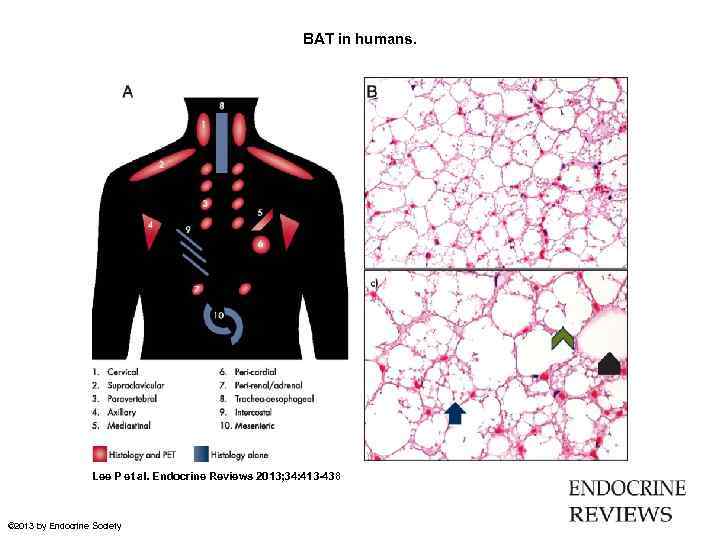 BAT in humans. Lee P et al. Endocrine Reviews 2013; 34: 413 -438 ©