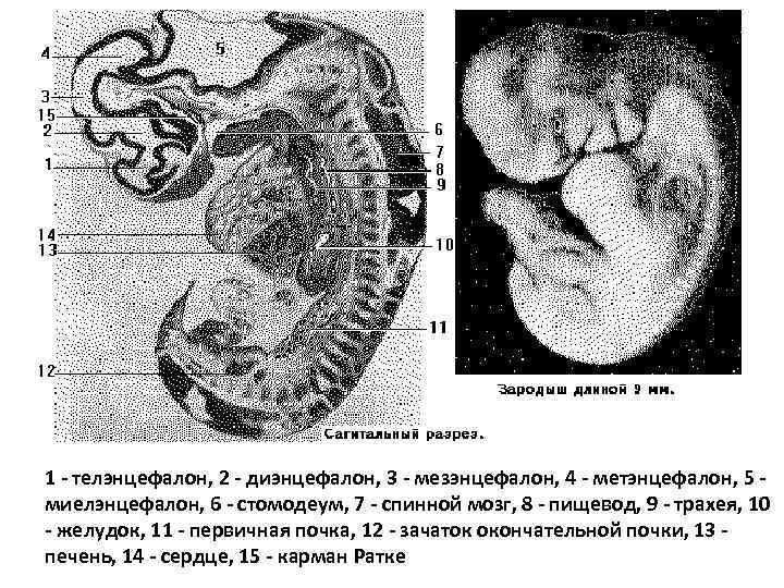 1 - телэнцефалон, 2 - диэнцефалон, 3 - мезэнцефалон, 4 - метэнцефалон, 5 миелэнцефалон,