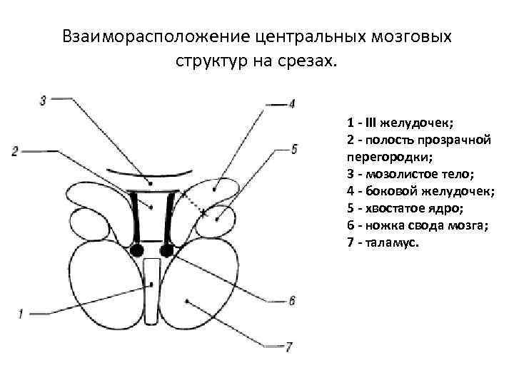 Взаиморасположение центральных мозговых структур на срезах. 1 - III желудочек; 2 - полость прозрачной