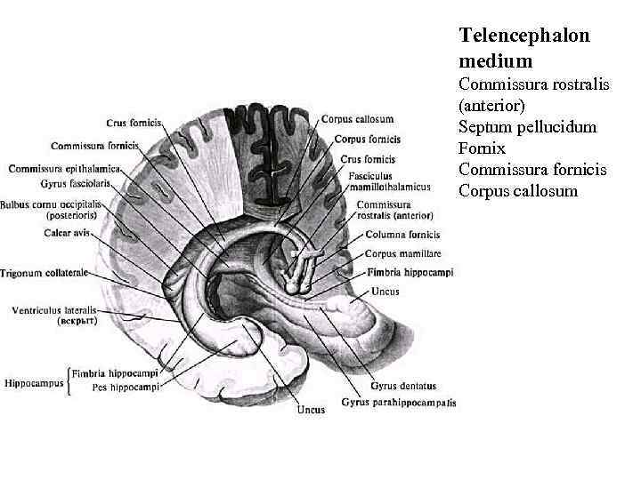 Telencephalon medium Commissura rostralis (anterior) Septum pellucidum Fornix Commissura fornicis Corpus callosum 