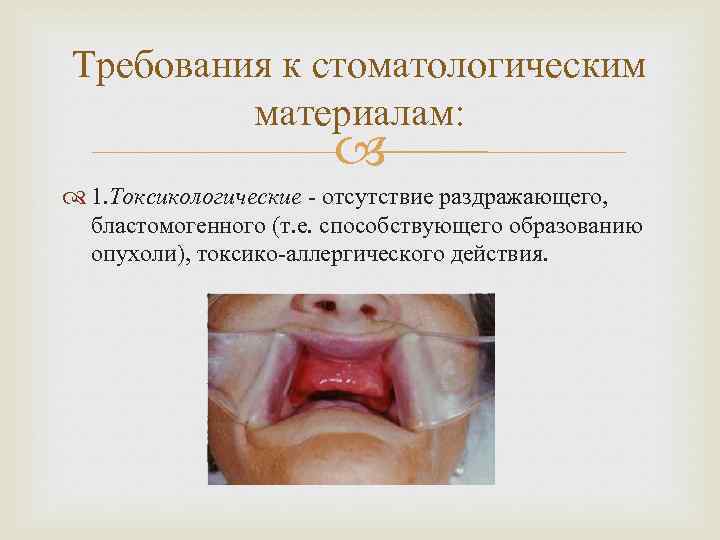 Требования к стоматологическим материалам: 1. Токсикологические - отсутствие раздражающего, бластомогенного (т. е. способствующего образованию