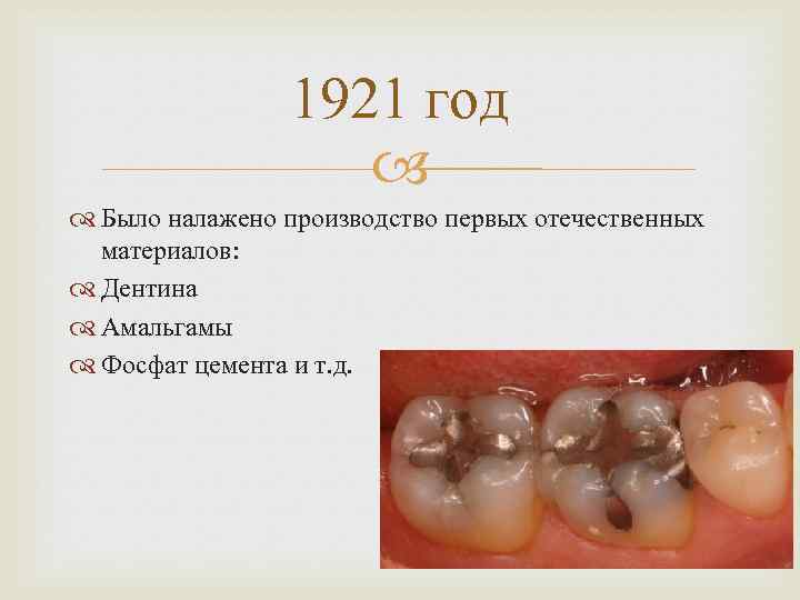 1921 год Было налажено производство первых отечественных материалов: Дентина Амальгамы Фосфат цемента и т.