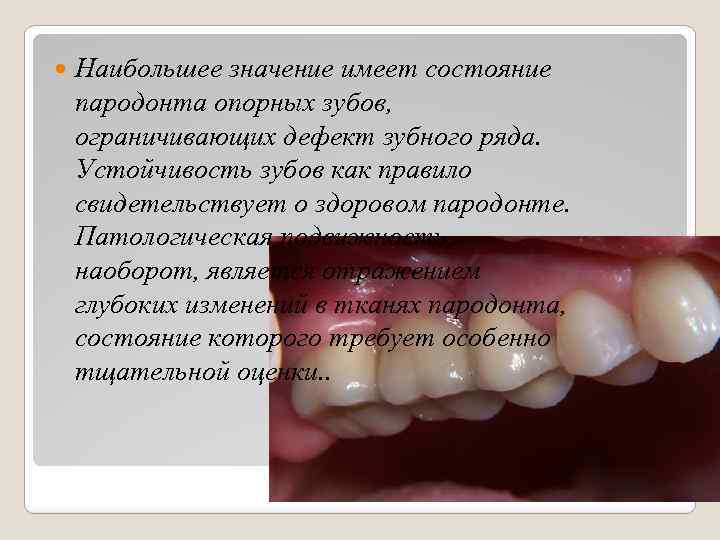  Наибольшее значение имеет состояние пародонта опорных зубов, ограничивающих дефект зубного ряда. Устойчивость зубов