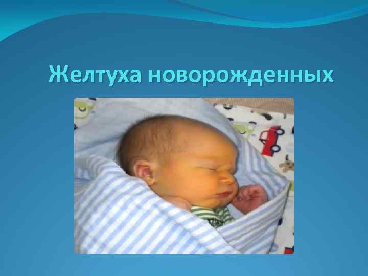 Желтуха новорожденных 