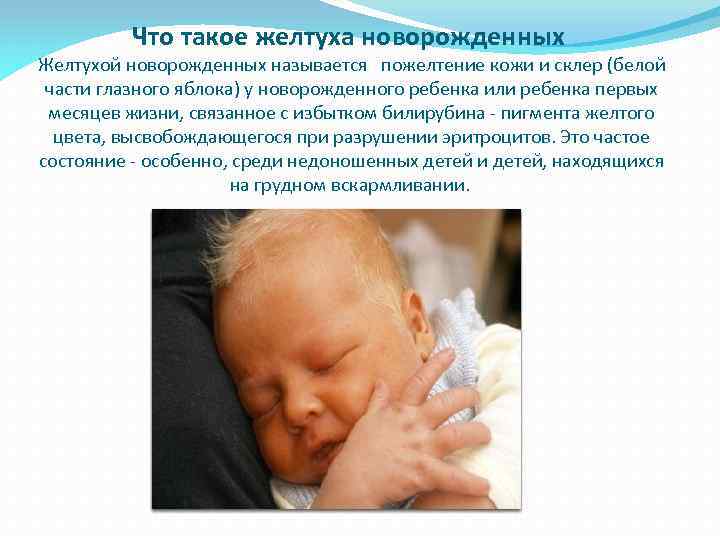 Что такое желтуха новорожденных Желтухой новорожденных называется пожелтение кожи и склер (белой части глазного