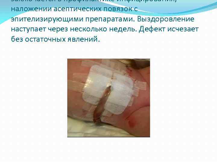 заключается в профилактике инфицирования, наложении асептических повязок с эпителизирующими препаратами. Выздоровление наступает через несколько