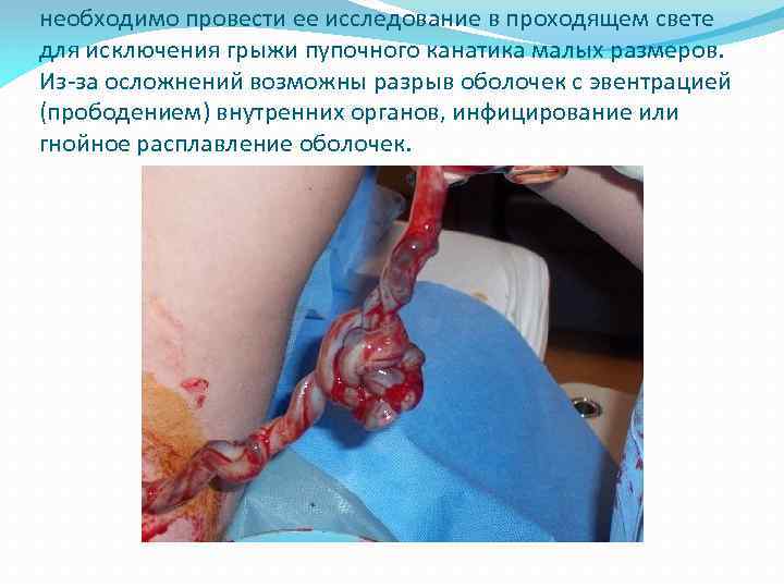 необходимо провести ее исследование в проходящем свете для исключения грыжи пупочного канатика малых размеров.