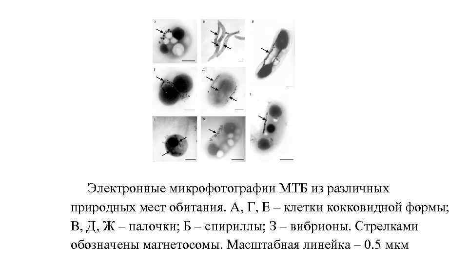 Электронные микрофотографии МТБ из различных природных мест обитания. А, Г, Е – клетки кокковидной