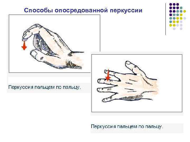 Способы опосредованной перкуссии 