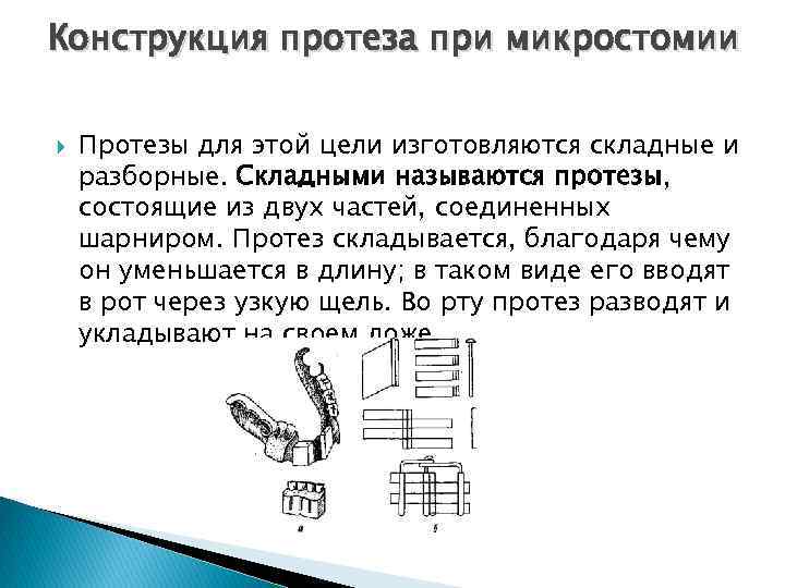 Конструкция протеза при микростомии Протезы для этой цели изготовляются складные и разборные. Складными называются