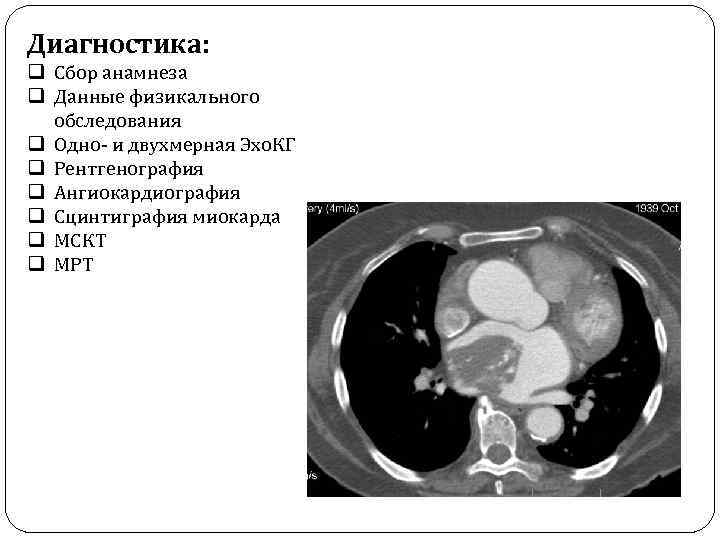 Диагностика: q Сбор анамнеза q Данные физикального обследования q Одно- и двухмерная Эхо. КГ