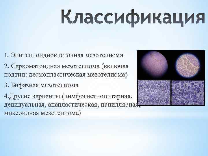 1. Эпителиоидноклеточная мезотелиома 2. Саркоматоидная мезотелиома (включая подтип: десмопластическая мезотелиома) 3. Бифазная мезотелиома 4.