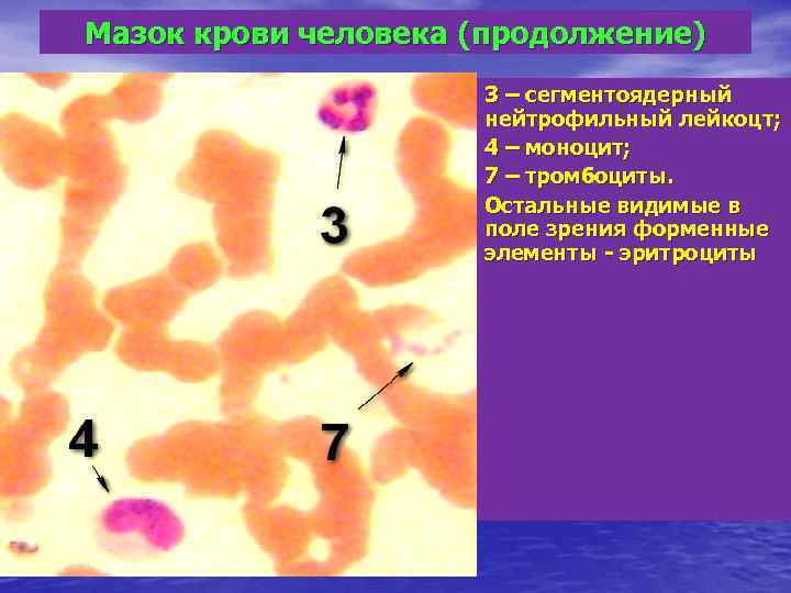 Мазок крови человека (продолжение) 3 – сегментоядерный нейтрофильный лейкоцт; 4 – моноцит; 7 –