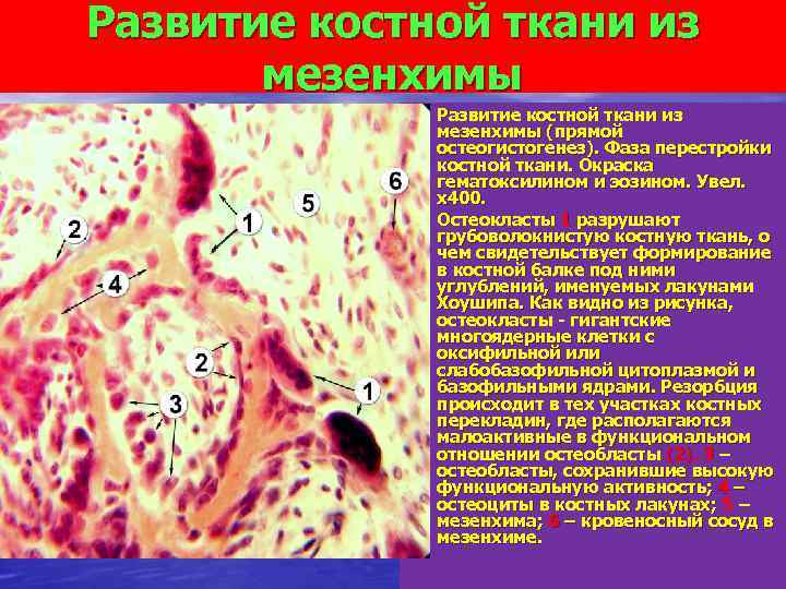 Развитие костной ткани из мезенхимы • Развитие костной ткани из • мезенхимы (прямой остеогистогенез).