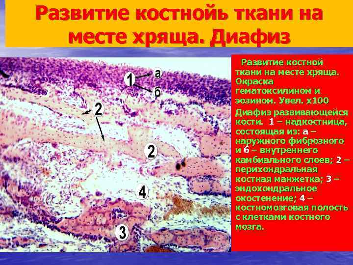 Развитие костнойь ткани на месте хряща. Диафиз Развитие костной ткани на месте хряща. Окраска