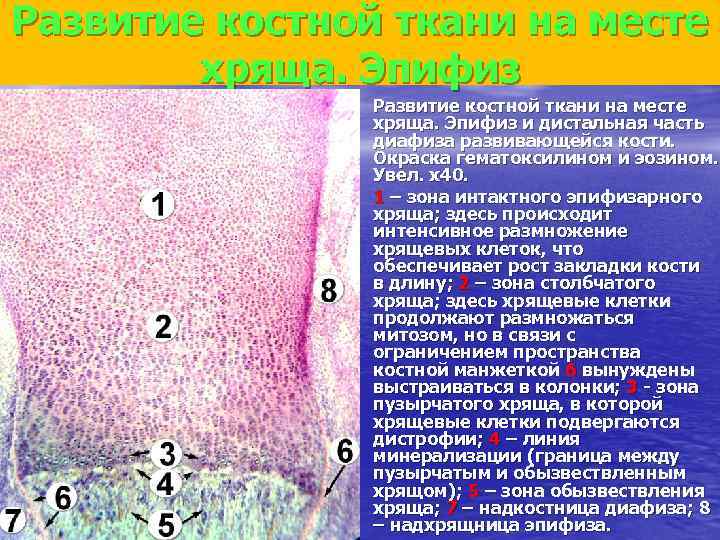 Эпифизарный хрящ. Эпифиз гистология препарат. Развитие кости на месте хряща гистология. Эпифиз гематоксилин эозин препарат. Непрямой остеогенез препарат.